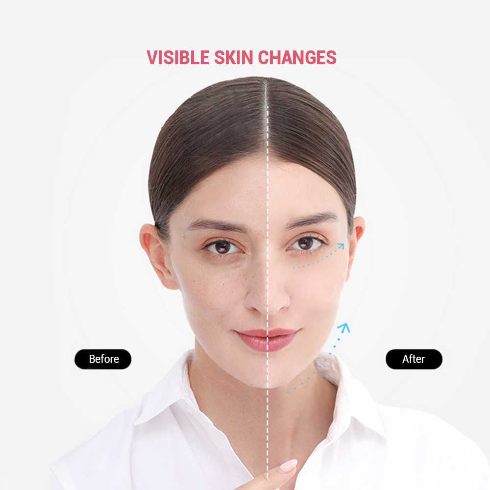 inFace MS7100 Ultrasonic Peeling Machine Beauty Facial Cleanser